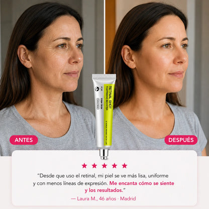 Antes y después del uso del Retinal Shot